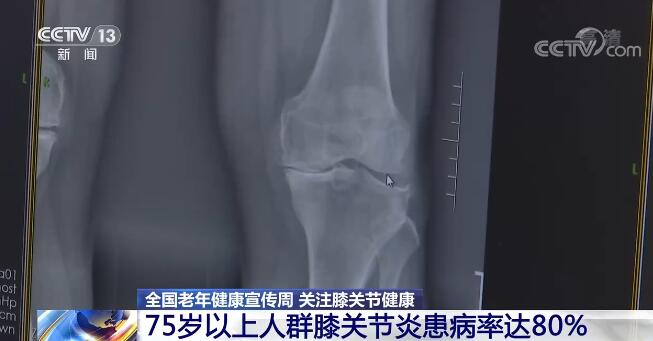 2022年全国老年健康宣传周启动 